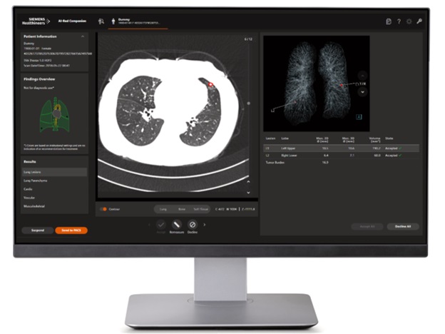 AI in Siemens Healthineers