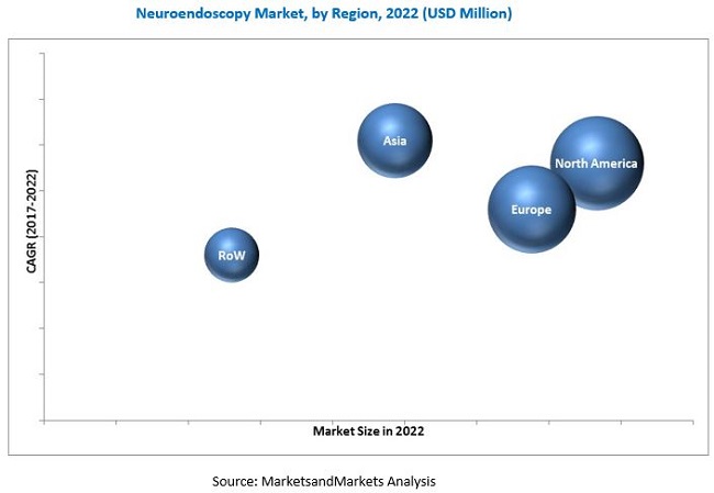 Neuroendoscopy Market - By Region 2022