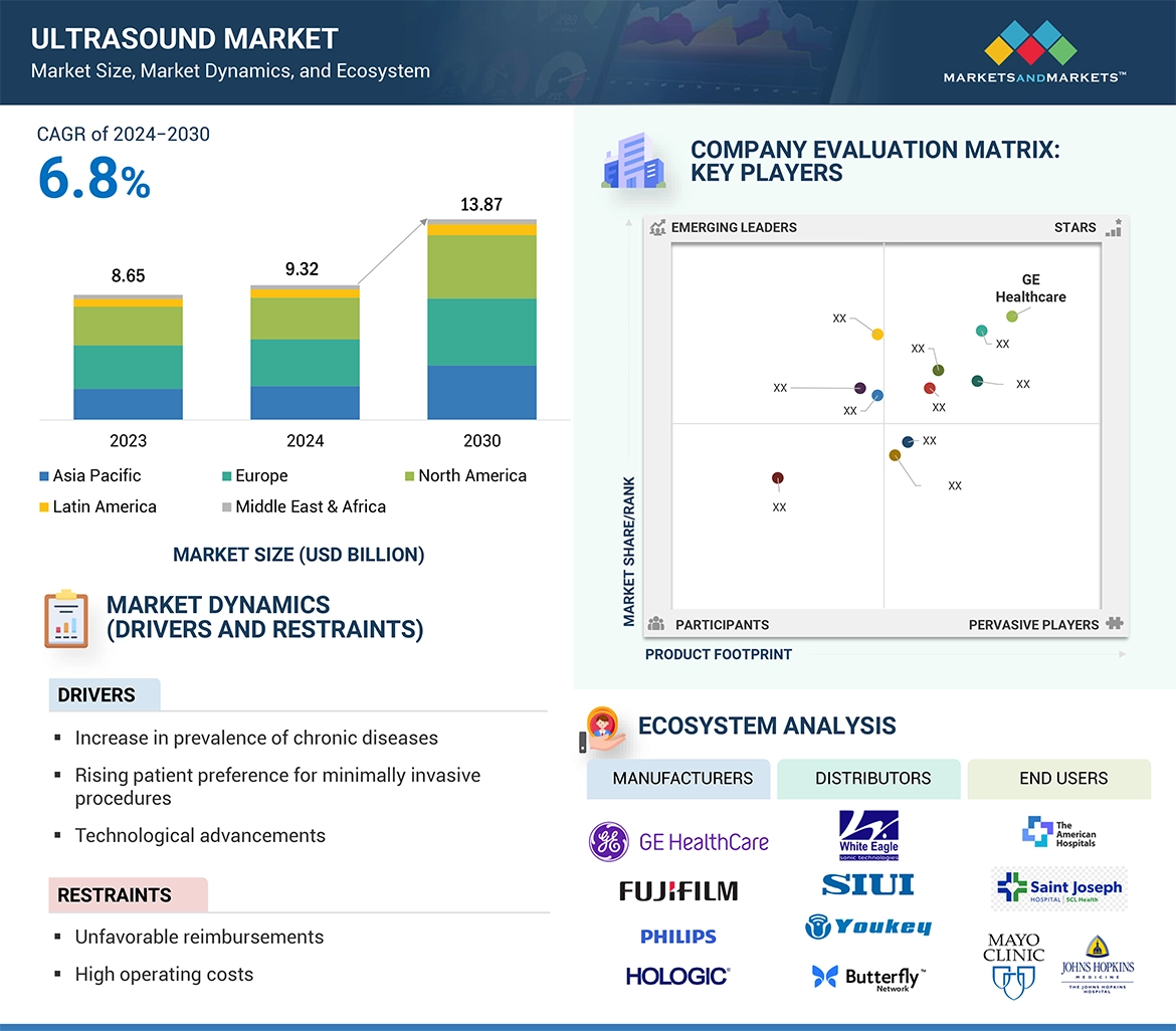 Ultrasound Market